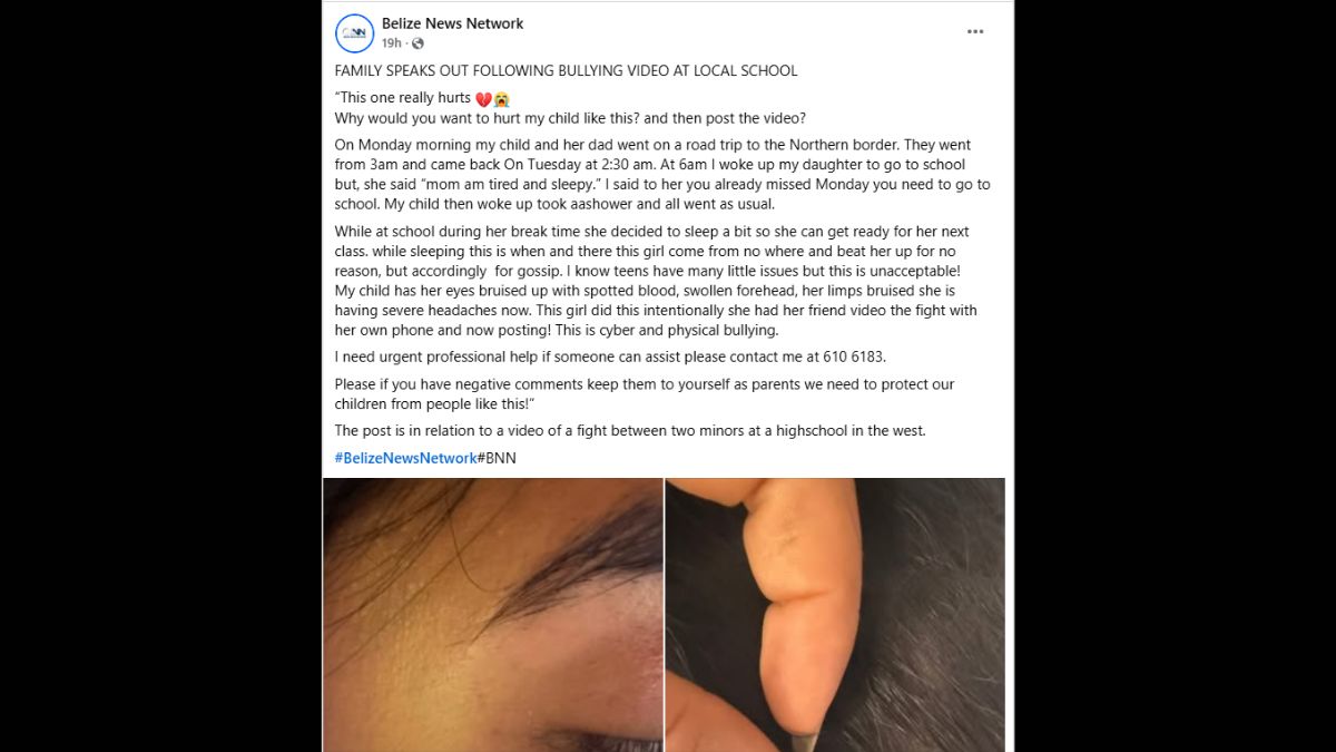 Mother Speaks Out After Daughter Beaten and Bruised in School Bullying Incident Caught on Video
